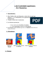 3- Fracture de la tete humerale.doc