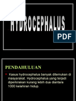HIDROCEPHALUS PPT 1