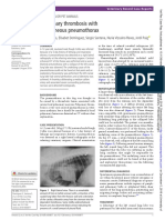 Pulmonary Thrombosis