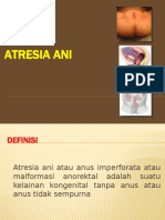 ATRESIA ANI.pptx