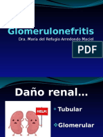 Glomerulonefritis