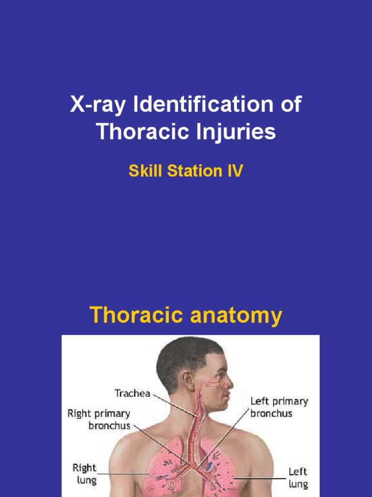 X-ray Guide for Thoracic Injuries | PDF | Thorax | Thorax (Human Anatomy)
