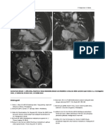 Rongga Peritoneum - En.id