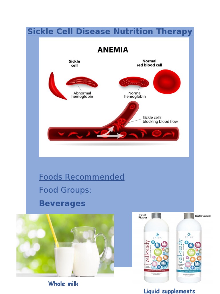 Sickle Cell Disease Therapy | PDF | Soup | Cream