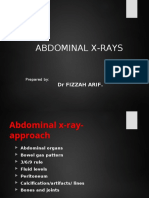 Abdominal X-Rays: DR Fizzah Arif