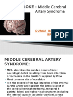 Stroke:: Middle Cerebral Artery Syndrome