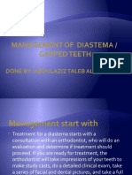 Management of Diastema / Gapped Teeth: Done By:Abdulaziz Taleb Alshammari