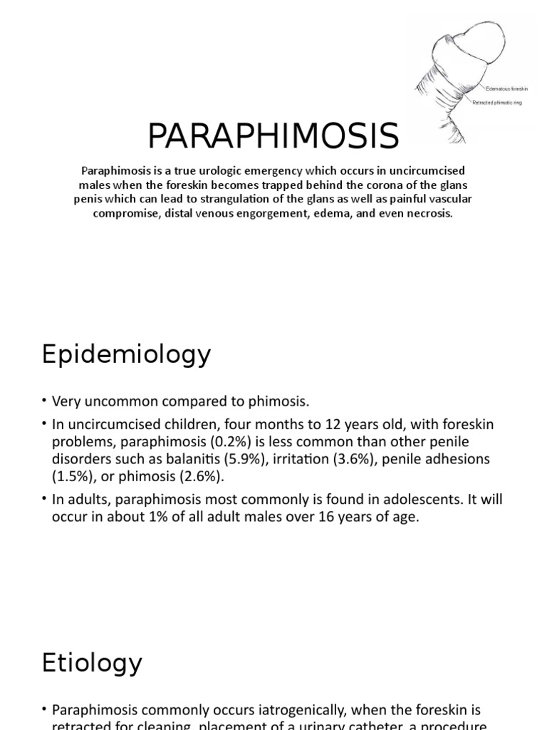Phimosis, Paraphimosis et circoncision - Pediatric Surgery