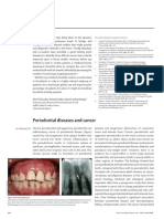 Periodontal Diseases and Cancer: Re Ection and Reaction
