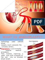 Angioplasty