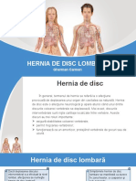 Hernia de Disc