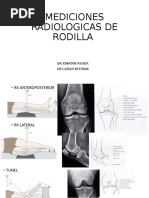 Eficiencia del Método Merchant en Rótula | PDF | Rodilla | Imagenes medicas