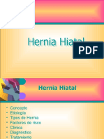 Hernia Hietall