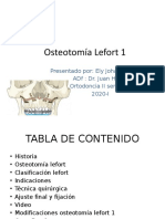 Osteotomía Lefort 1 