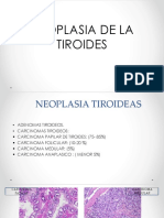 Trastornos neoplásicos de tiroides, paratiroides, pancreas y medula suprarenalhipófisis, páncreas, .pdf