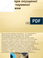 Розборська М. Я. 31ФТЕ масаж при опущенні органів черевної порожнини