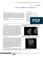 Breast Metastasis From A Malignant Melanoma - A PDF