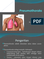 Pneumothoraks