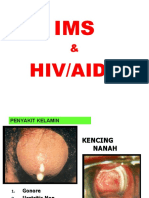 IMS-HIV-AIDS