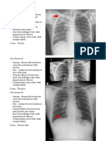 Foto Thorax Radiologi