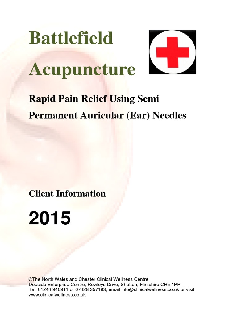 Battlefield Acupuncture PDF Acupuncture Pain Management