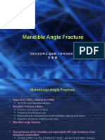 Mandible Angle Fracture 01