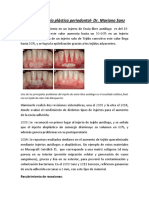 Cirugía plástica Periodontal- Dr Sanz