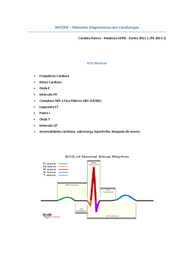 ECG: principais erros no plantão e como evitá-los - Sanarmed, image size:768x1024