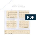 Interpretasi Ekg