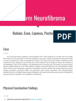 Group 3 - Plexiform Neurofibroma