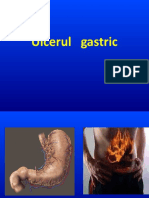 Chirurgie Generala Ulcerul Gastric