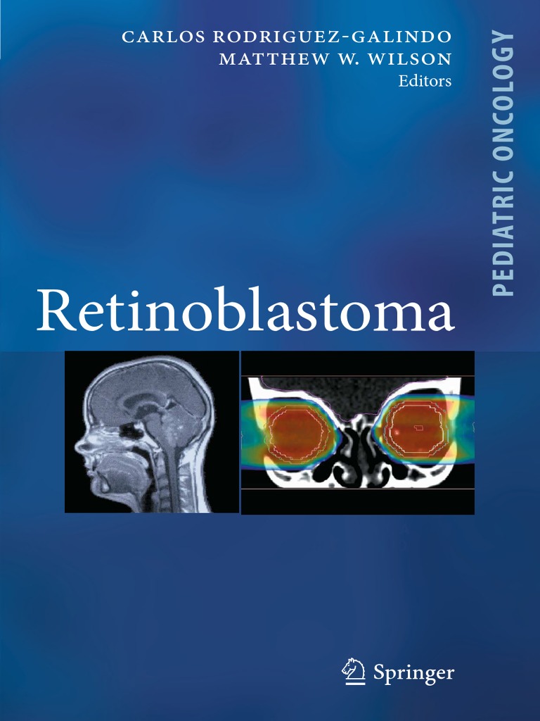 Retinoblastoma PDF Doctor Of Medicine Ophthalmology