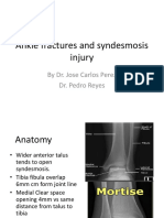Ankle fractures and syndesmosis injury treatment options