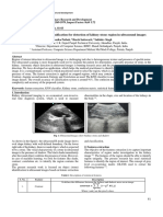 Features Extraction and Classification For Detection of Kidney Stone Region in Ultrasound Images