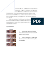 Strabismus