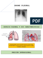 Sindrome Pleural