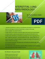 Interstitial Lung Diseases Radiology 22222