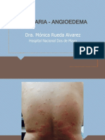 Urticaria - Angioedema