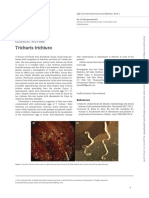 Trichuris Trichiura: Clinicalpicture