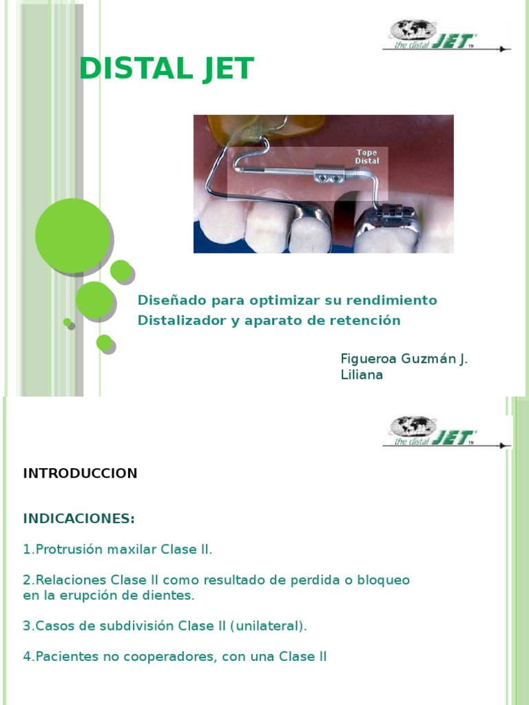 Distal Jet: Optimización en Ortodoncia | PDF | Hogar, jardinería y ...
