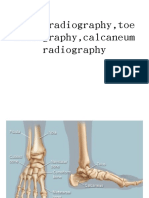 Ankle radiograp-WPS Office