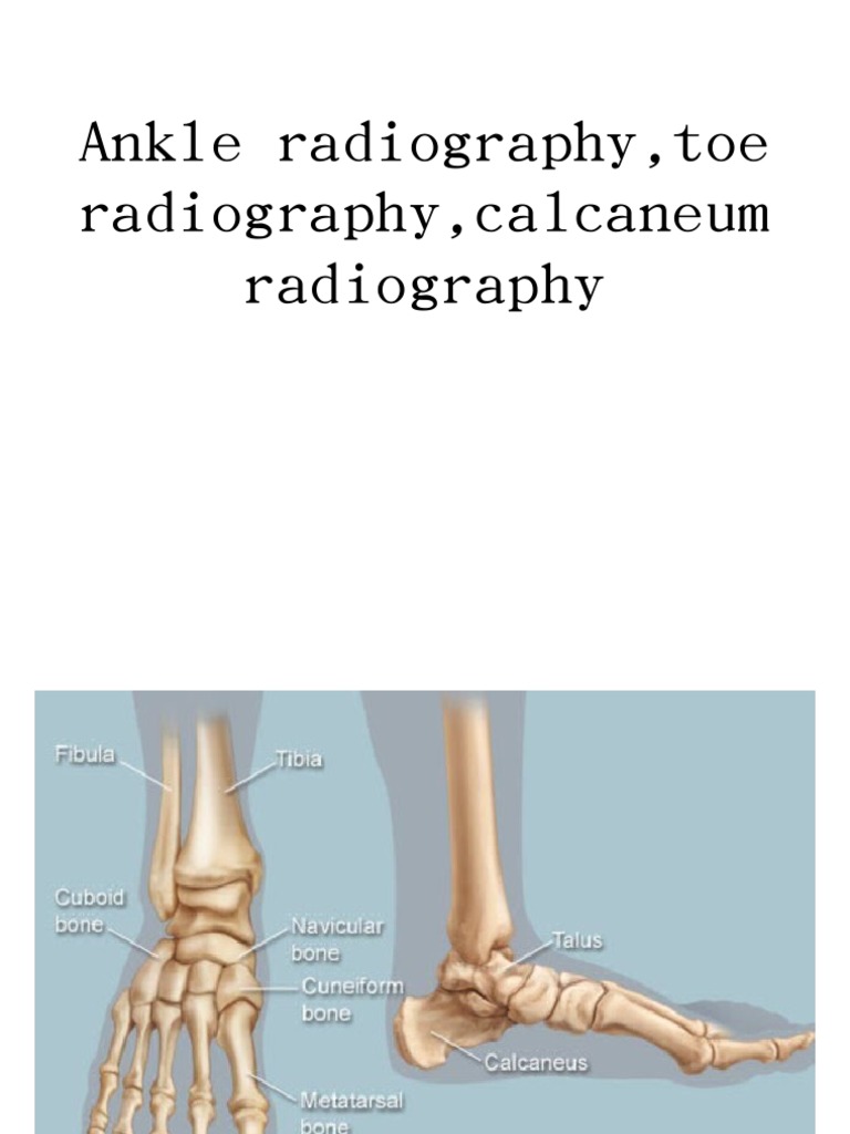 Ankle radiograp-WPS Office | PDF
