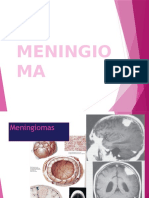 Meningioma Imagenologia