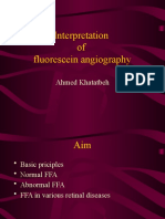 Interpretation of Fluorescein Angiography: Ahmed Khatatbeh