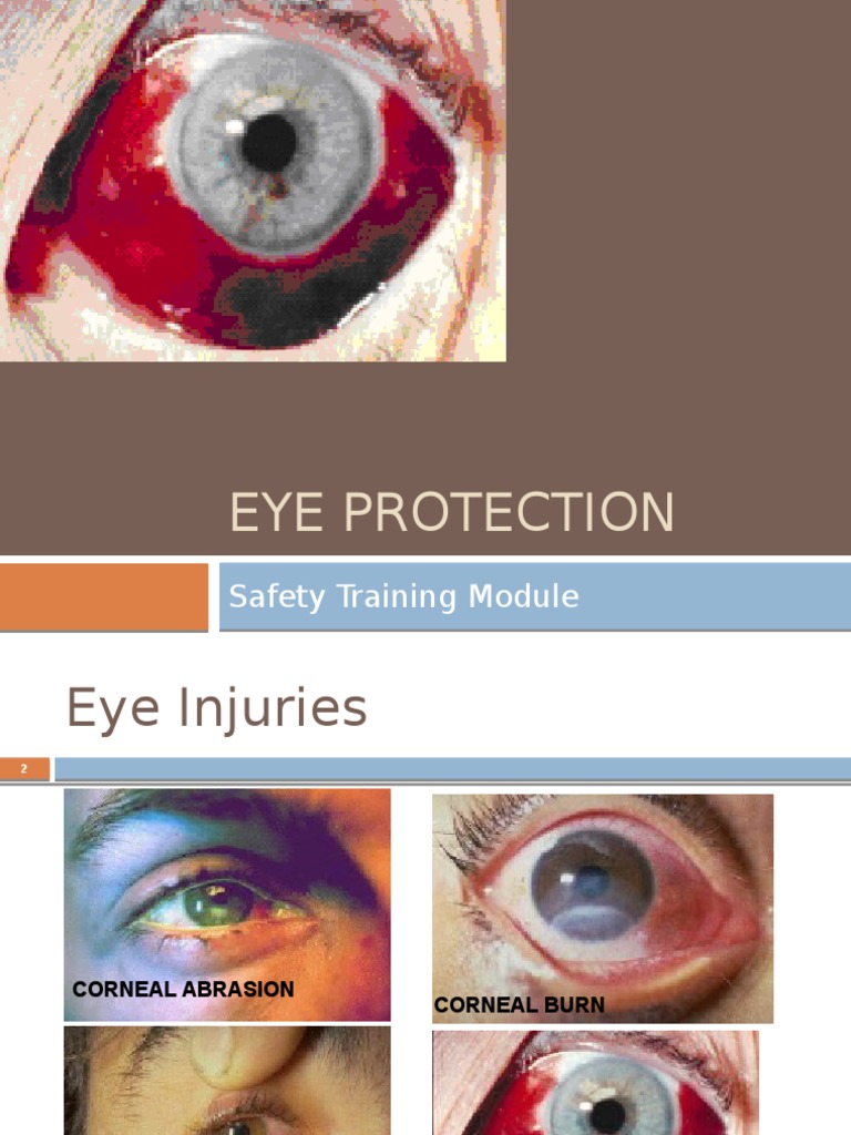 Eye Protection Safety Training Module Nature