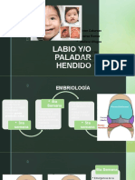 Labio y Paladar Hendido