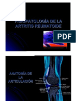 artritis_reumatoide 