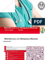 Mielofibrosis Con Metaplasia Mieloide