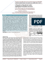 Pons Hepatis of Quadrate Lobe A Morphogical Variation of Liver