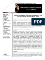 Massive Bleeding Post Tooth Extraction Diagnosed With Acute Myeloblastic Leukemia: A Case Report